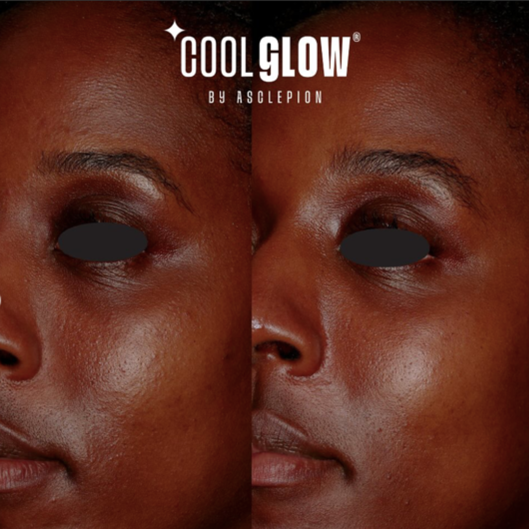 Cool Glow Face