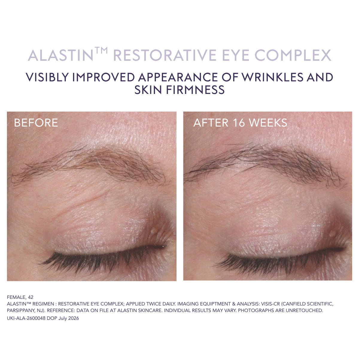 Alastin Restorative Eye Complex