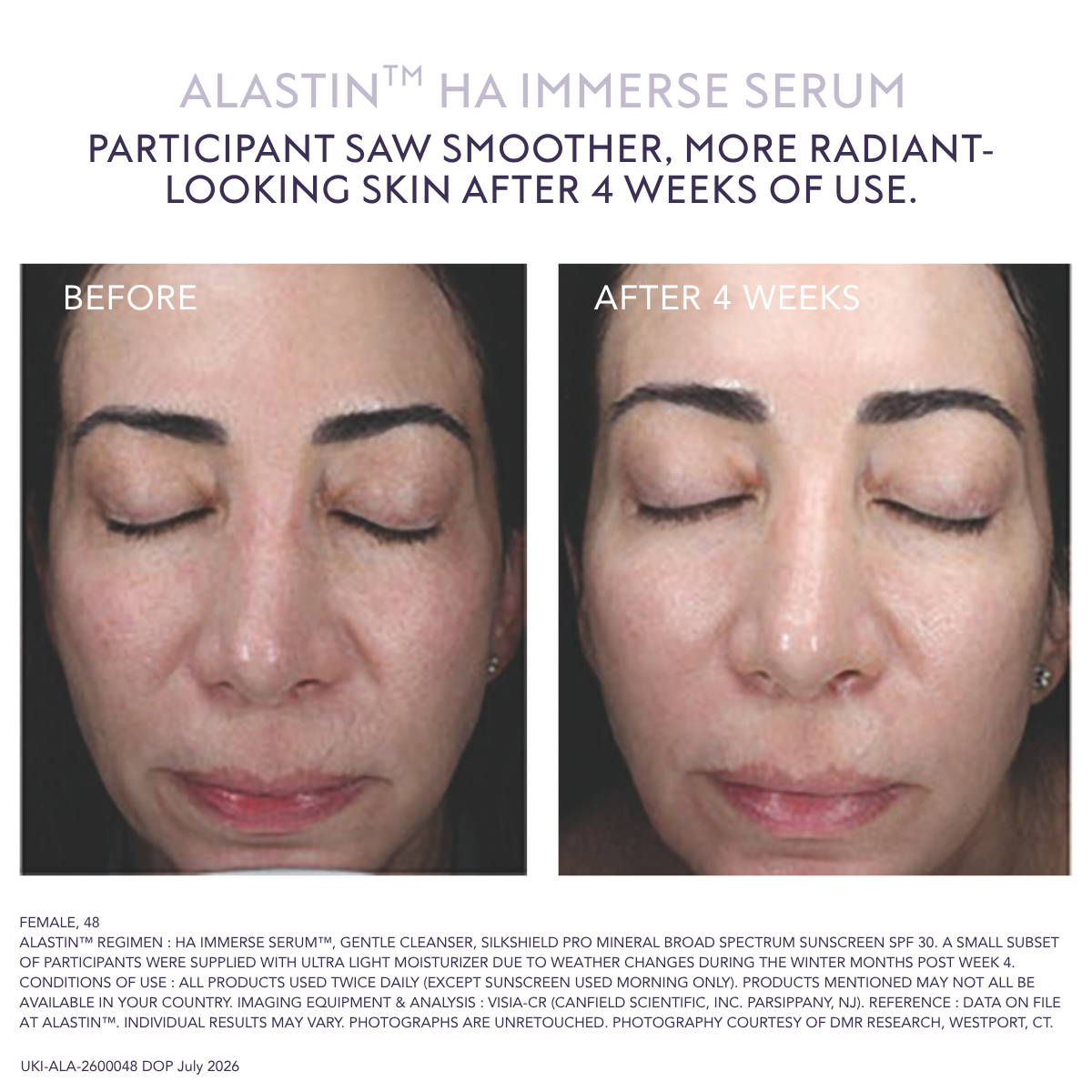 Alastin HA Immerse Serum