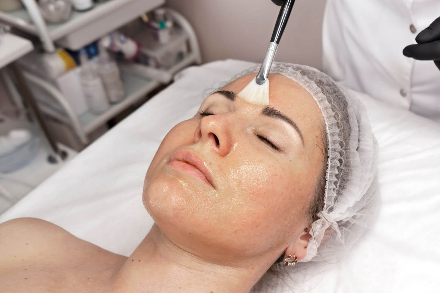 Bespoke Glow Chemical Peels (6 sessions)