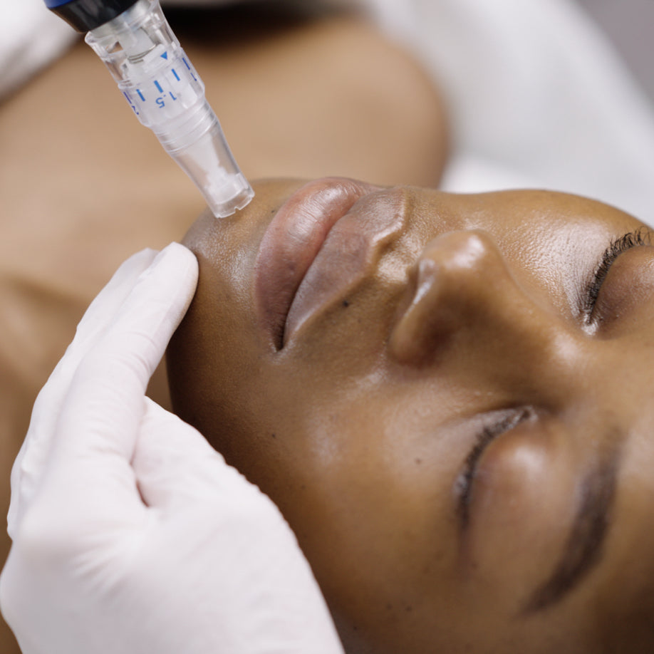 Micro-needling (6) with 1x Skin Nectar