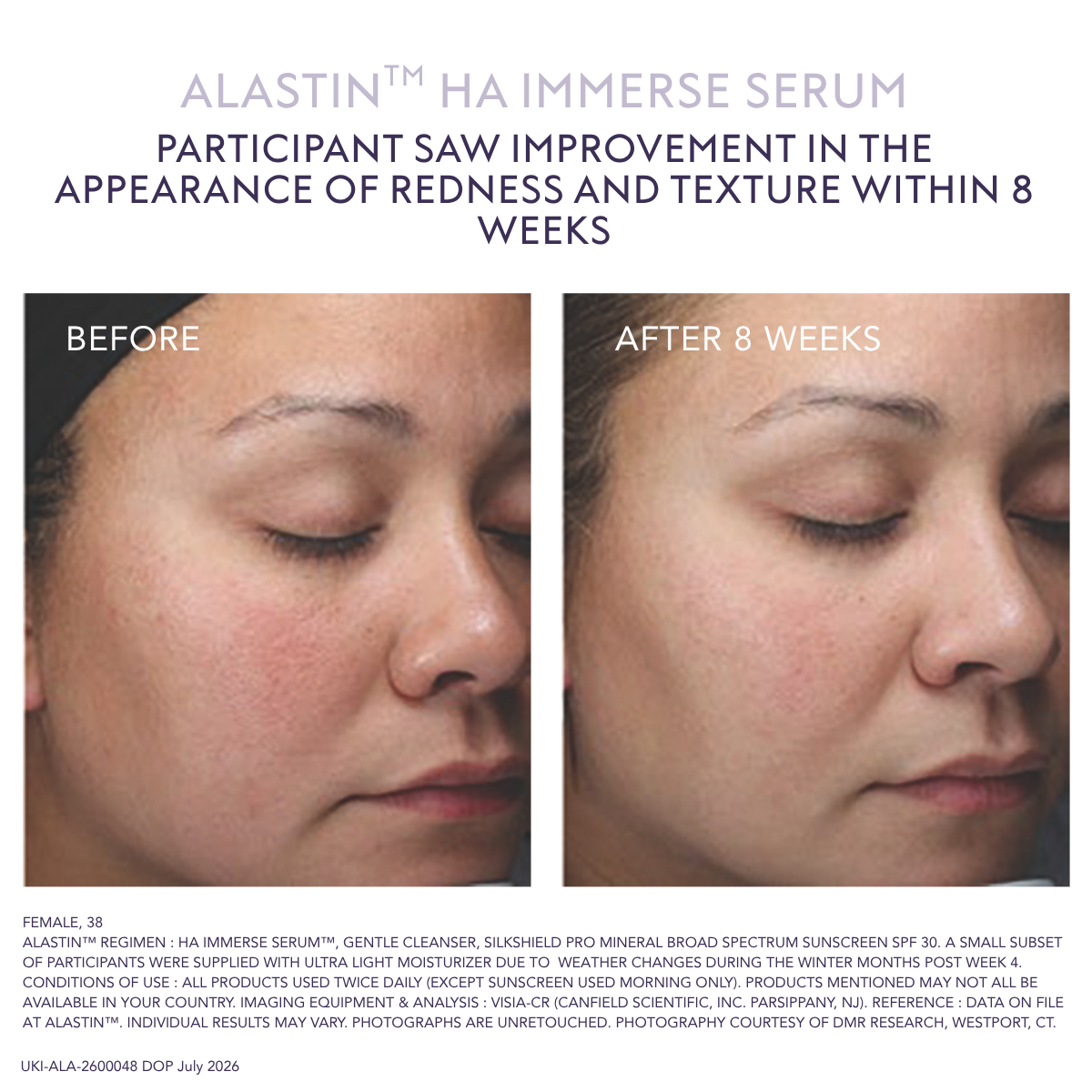 Alastin HA Immerse Serum