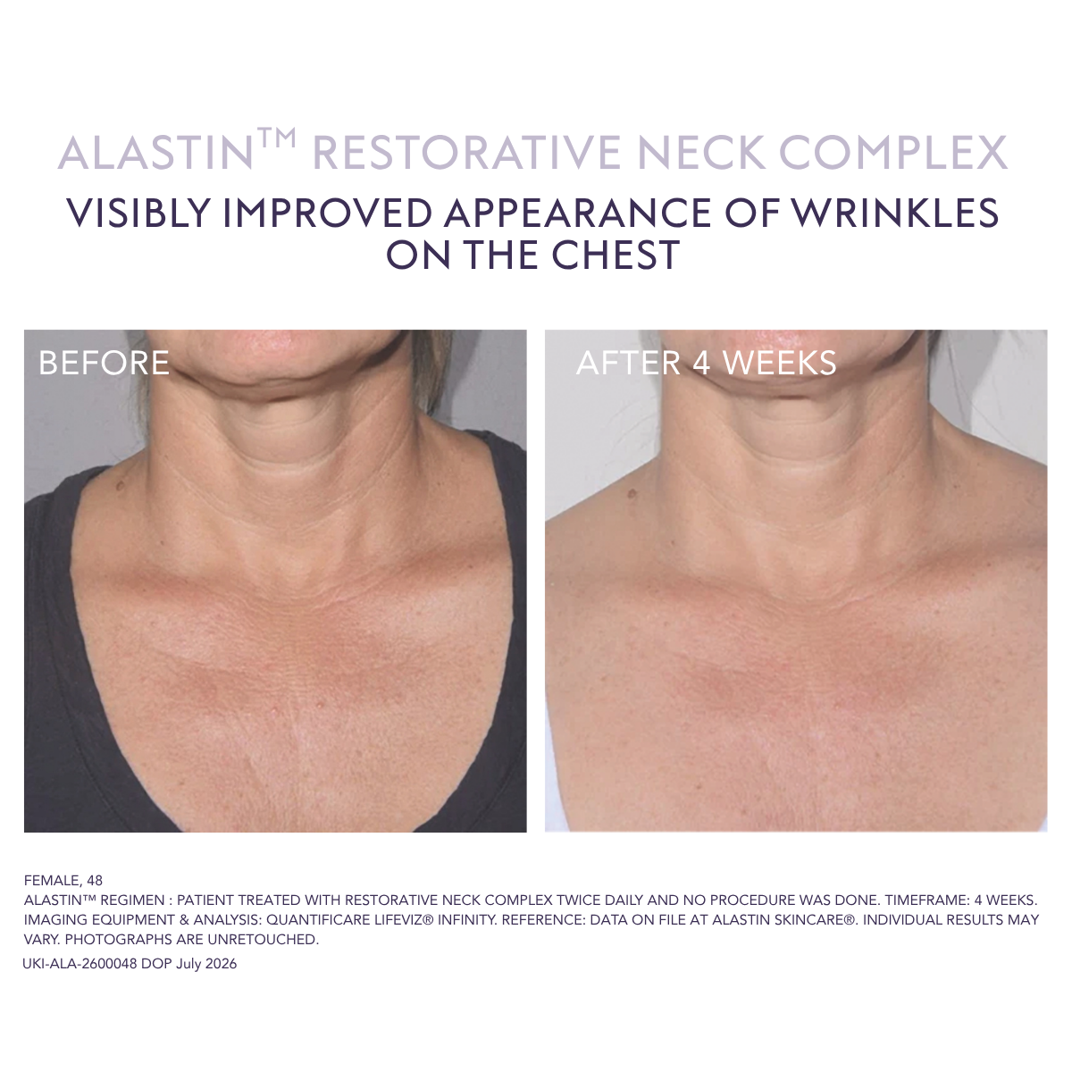 Alastin Restorative Neck Complex