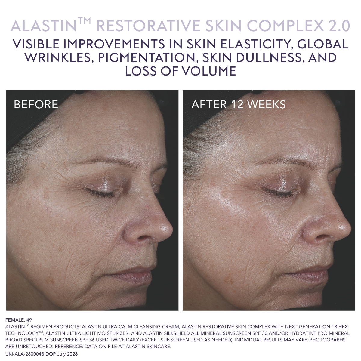 Alastin Restorative Skin Complex
