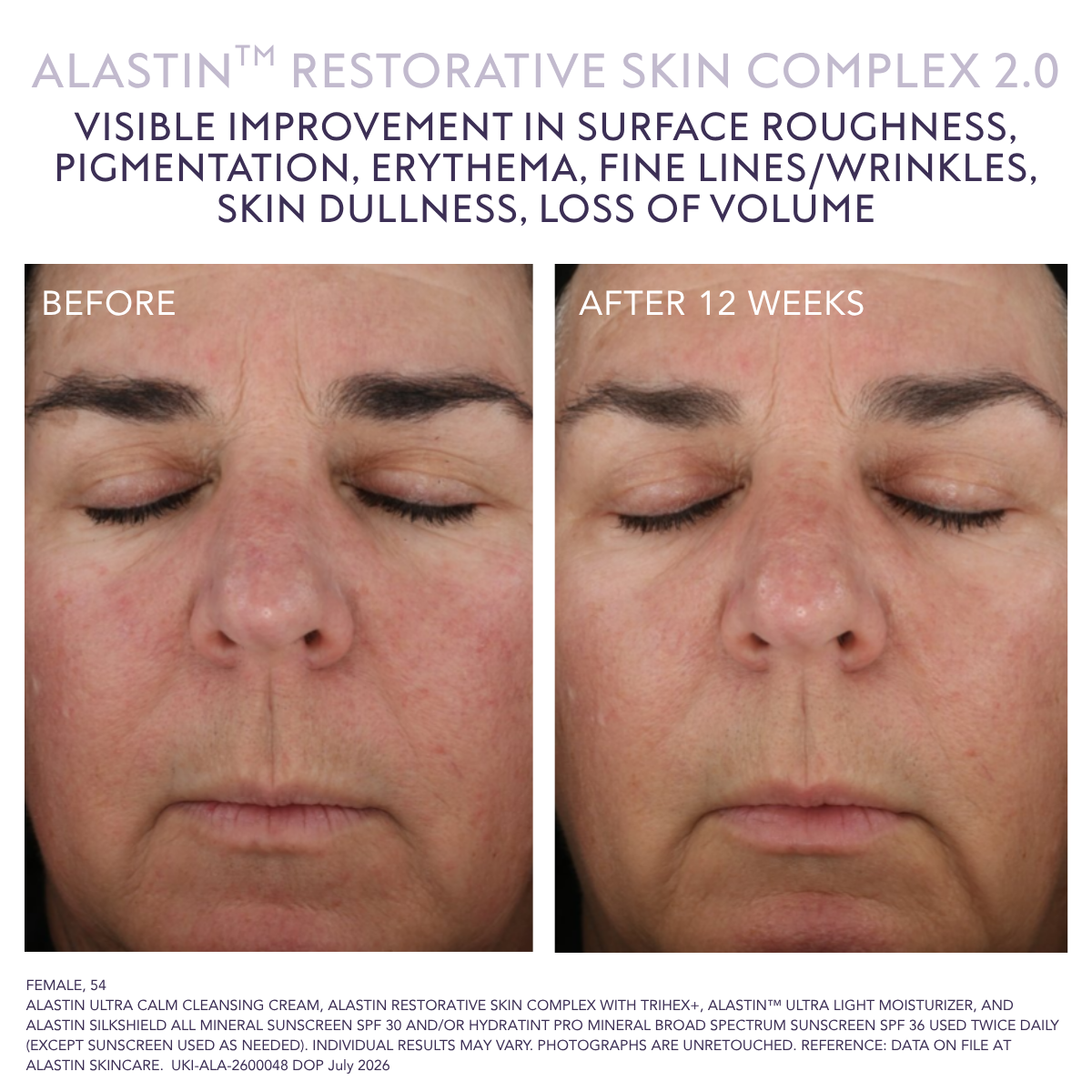 Alastin Restorative Skin Complex