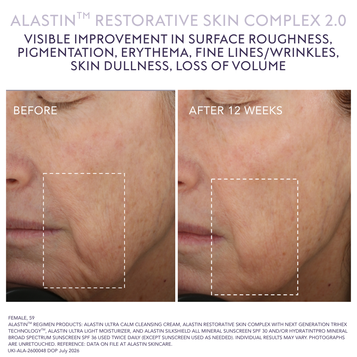 Alastin Restorative Skin Complex
